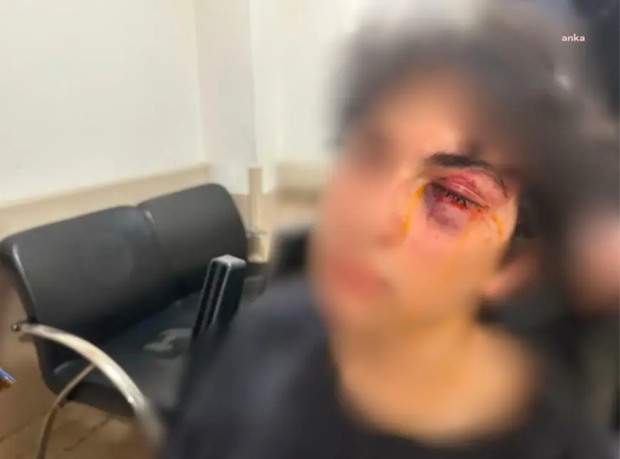 İstanbul'da CHP standında "Kurtuluş Yok Tek Başına" şarkısını söyleyen 15 yaşındaki çocuğa yumruklu saldırı iddiası